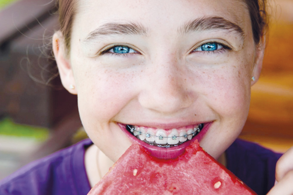 consejos-comida-brackets-1000x666.jpg